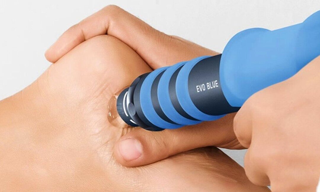 Shockwave Therapy: Unlocking Your Body’s Natural Healing Potential with Acoustic Waves
