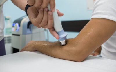 Shockwave Therapy for Tennis Elbow