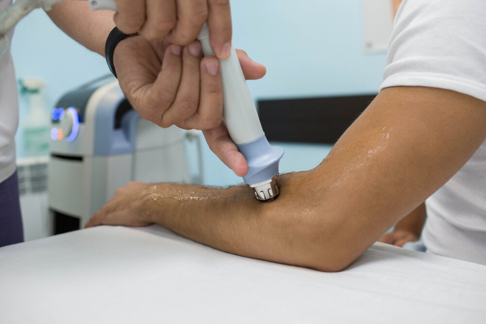 Shockwave Therapy for Tennis Elbow